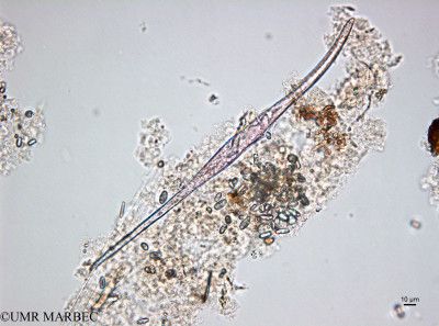 phyto/Brazilian_Amazon_coast/Amazomix_station_2/AMAZOMIX September 2021/Tripos falcatus (St2_tripos_cf_fusus220912_001_ovl-1).tif(copy)_thumb.jpg